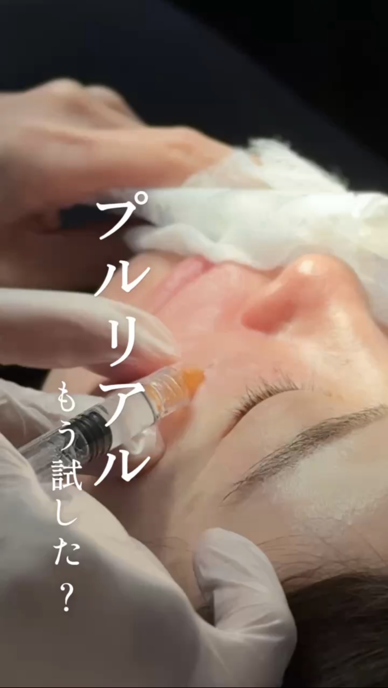 Instagram 動画サムネイル