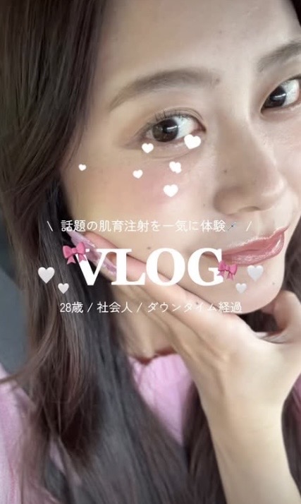 Instagram 動画サムネイル