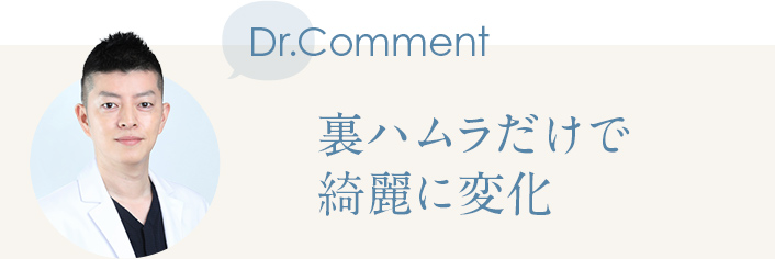 Dr.Comment 裏ハムラだけで綺麗に変化