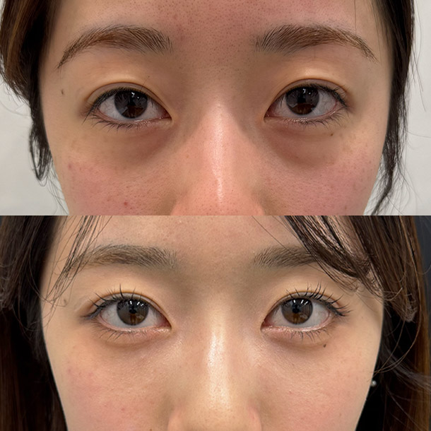 裏ハムラ ビフォーアフターイメージ