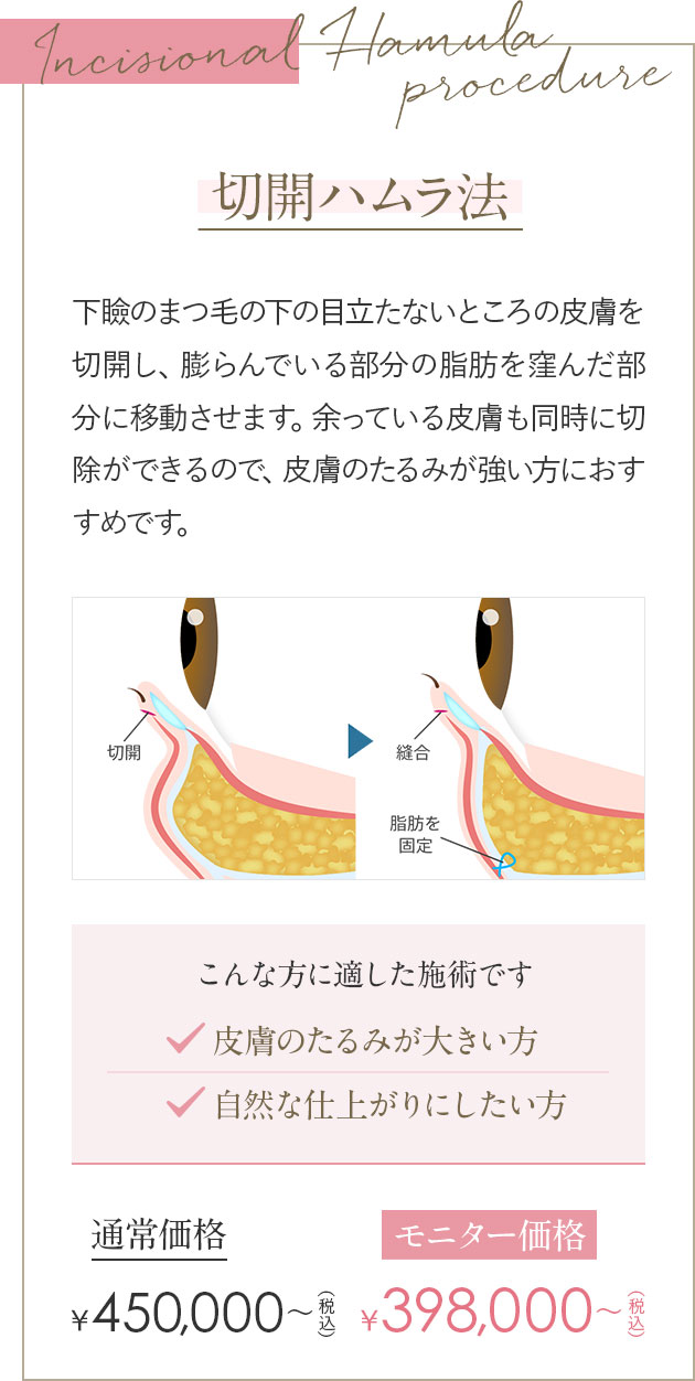 切開ハムラ法 下瞼のまつ毛の下の目立たないところの皮膚を切開し、膨らんでいる部分の脂肪を窪んだ部分に移動させます。余っている皮膚も同時に切除ができるので、皮膚のたるみが強い方におすすめです。こんな⽅に適した施術です 皮膚のたるみが大きい方／自然な仕上がりにしたい方
