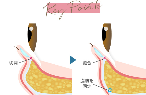 キーポイントイメージ