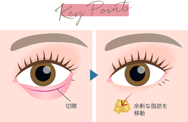 キーポイントイメージ