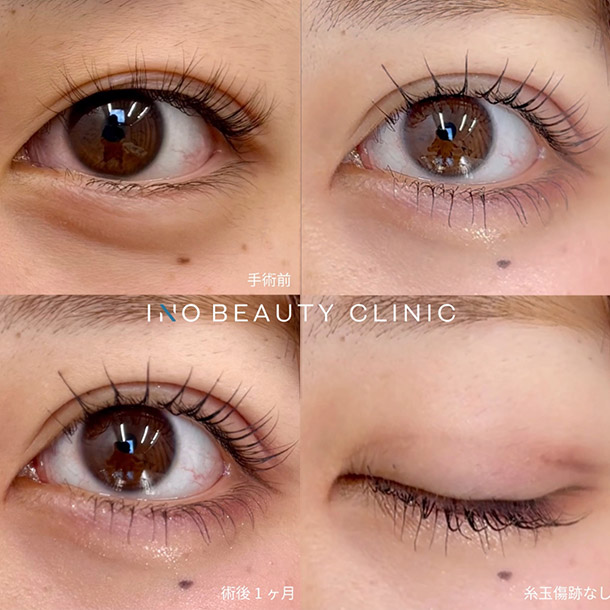 INOシークレットループ イメージ