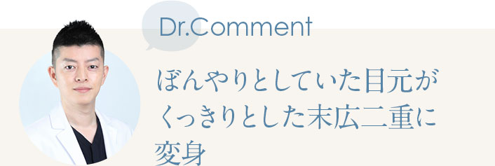 Dr.Comment ぼんやりとしていた目元がくっきりとした末広二重に変身