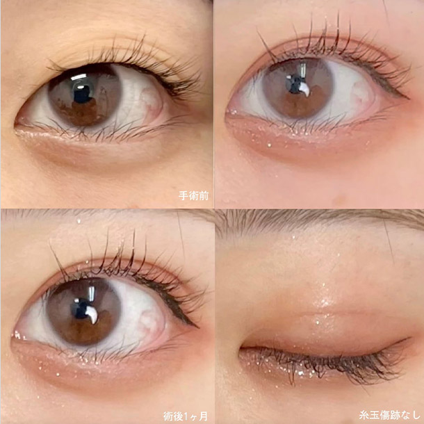 INOシークレットループ イメージ