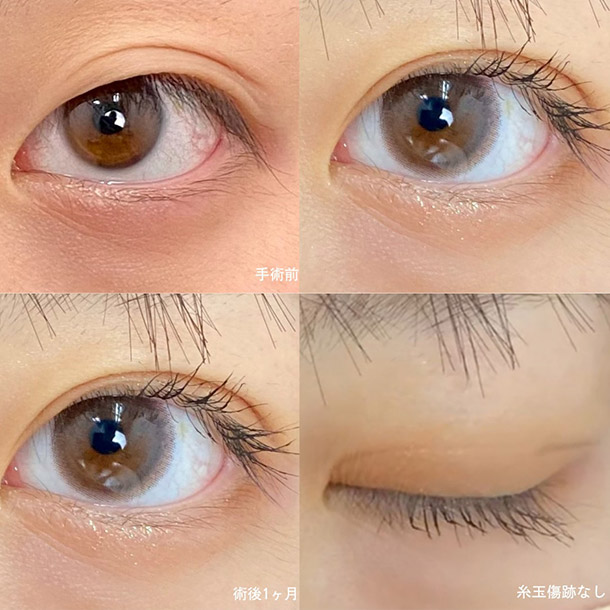 INOシークレットループ イメージ