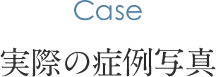 実際の症例写真