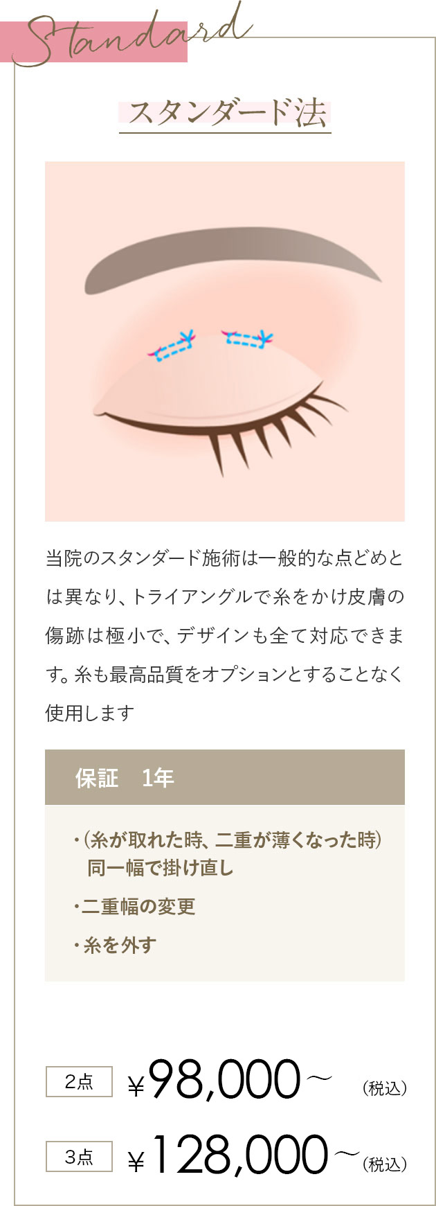 スタンダード 当院のスタンダード施術は一般的な点どめとは異なり、トライアングルで糸をかけ皮膚の傷跡は極小で、デザインも全て対応できます。糸も最高品質をオプションとすることなく使用します