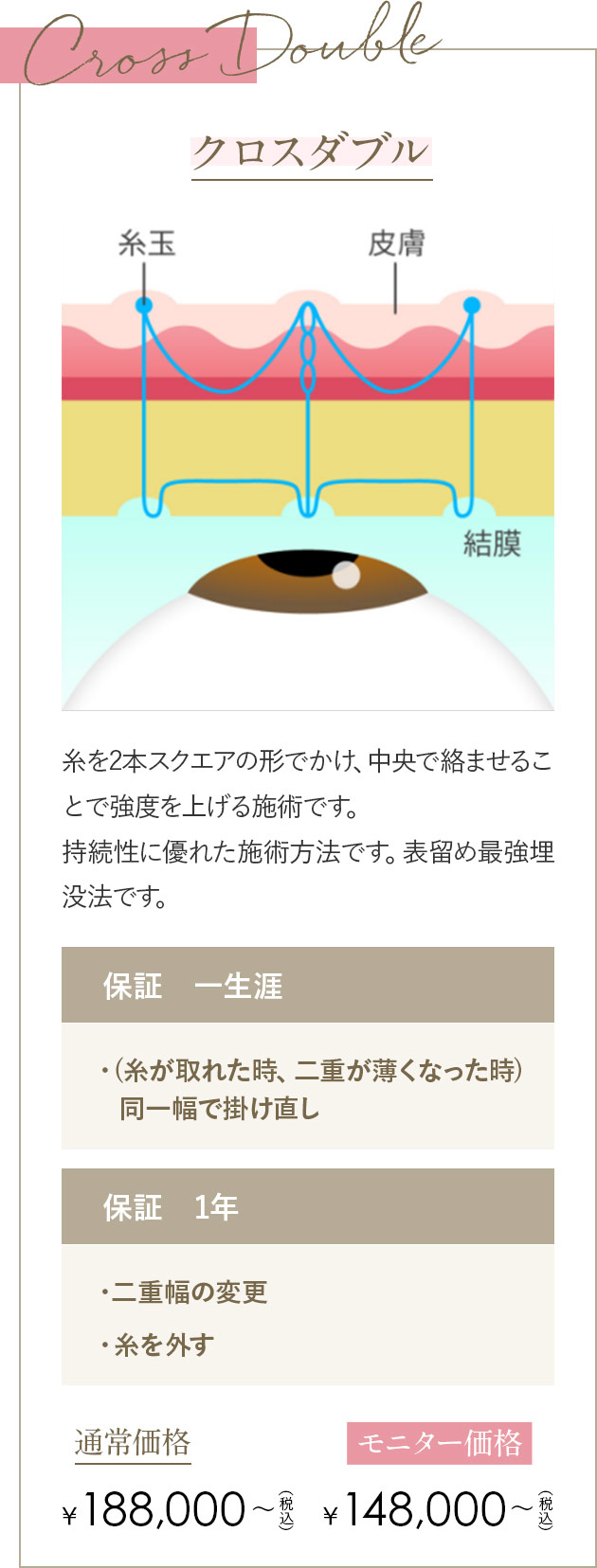 クロスダブル 糸を2本スクエアの形でかけ、中央で絡ませることで強度を上げる施術です。持続性に優れた施術方法です。表留め最強埋没法です。