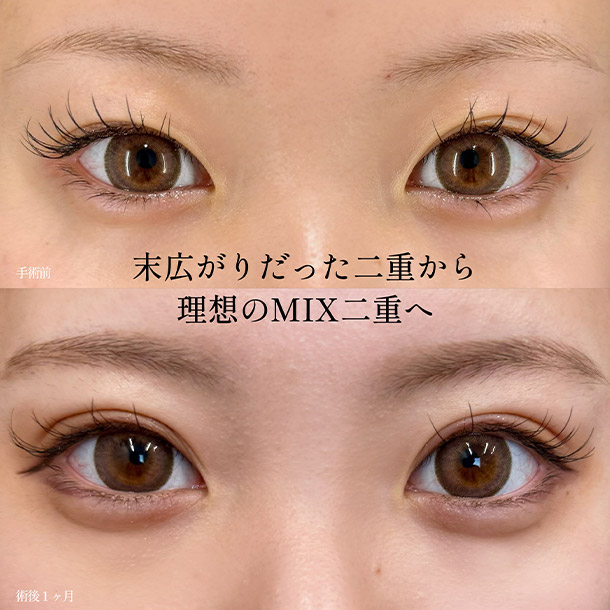 「INOシークレットループトリプル」イメージ